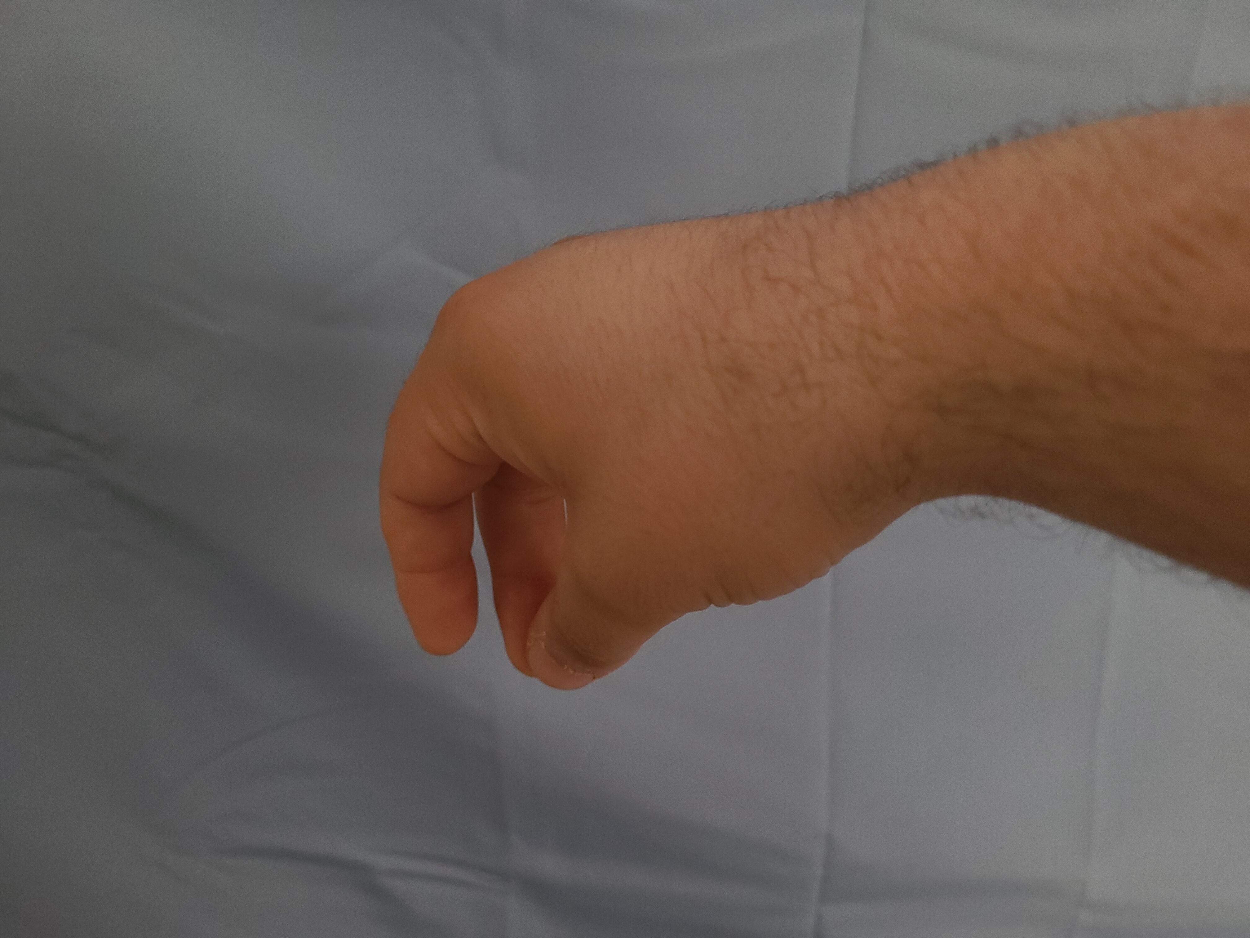 Thumb and middle finger, view 1