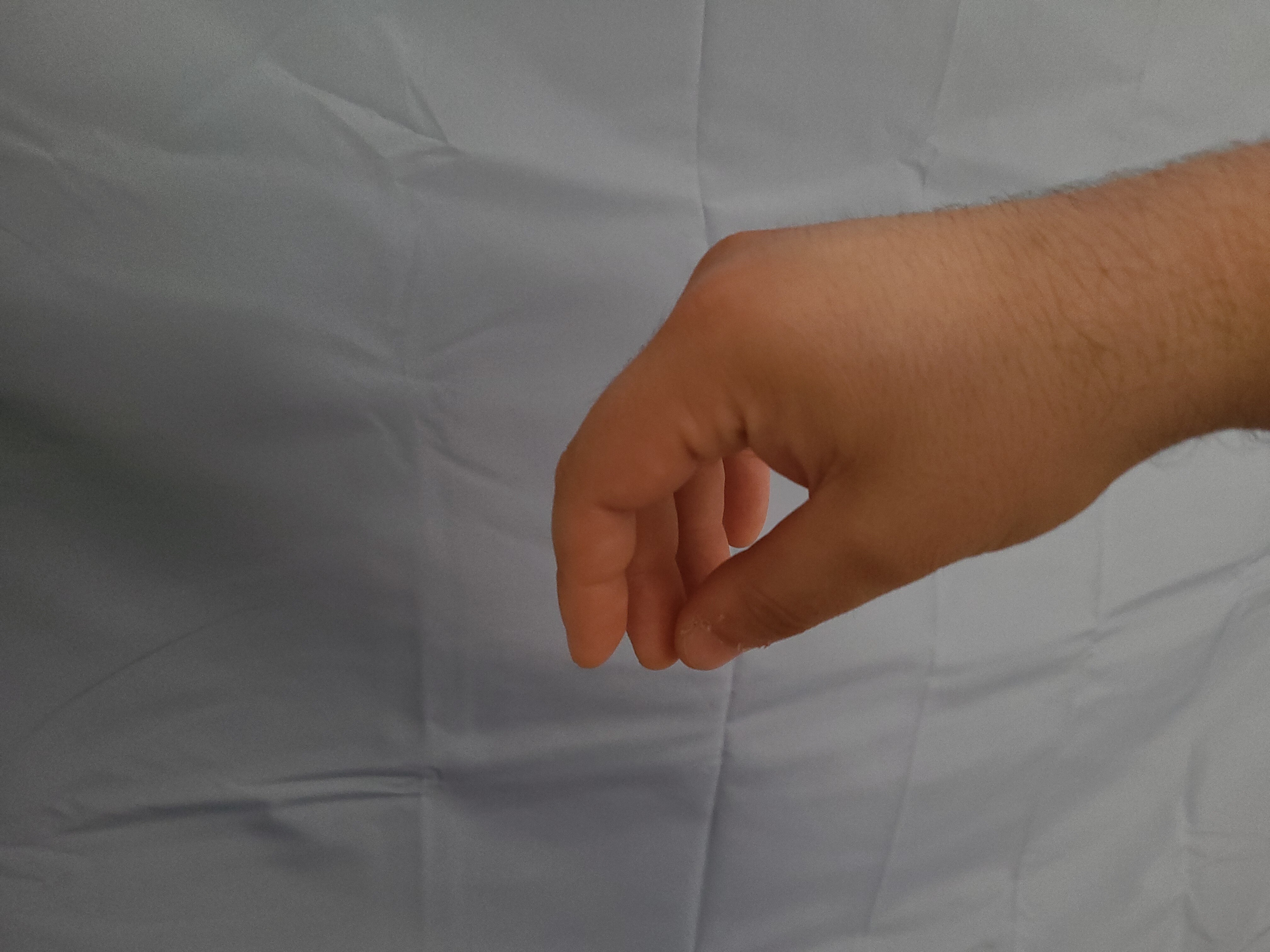 Thumb and middle finger, view 3